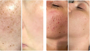 before and after image